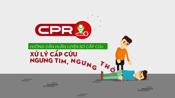 CPR là gì Tìm hiểu các thông tin về CPR