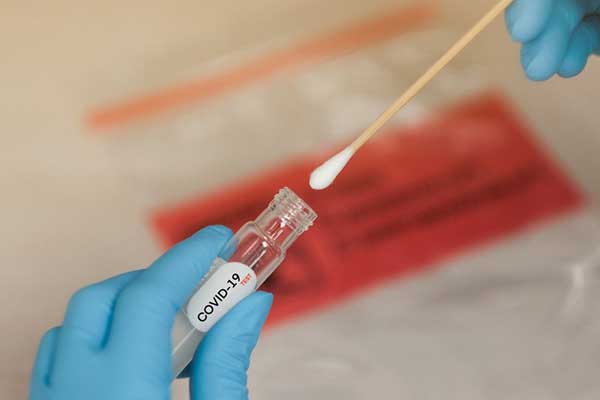 Những điều cần biết về Xét nghiệm PCR và test nhanh Covid-19